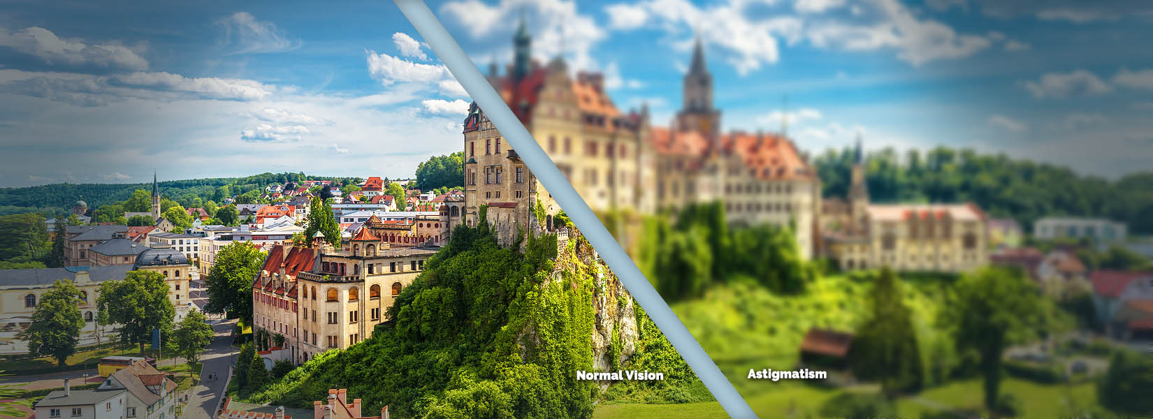 Astigmatism Treatment in Ladue