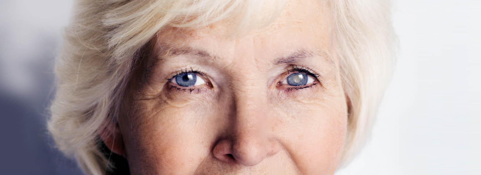 Cataract Surgery in Ladue